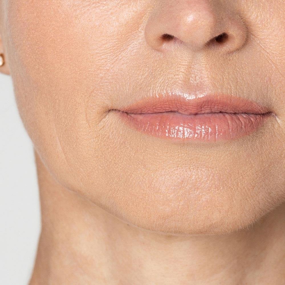 RMAA17PROGELIN-Progeline